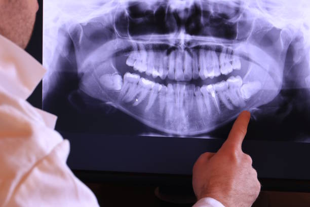 Best Dental Abscess Treatment in Huntland, TN