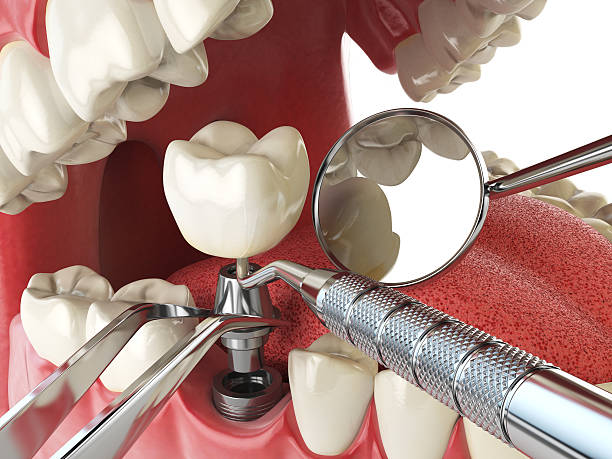 Best Emergency Orthodontic Repairs in Huntland, TN