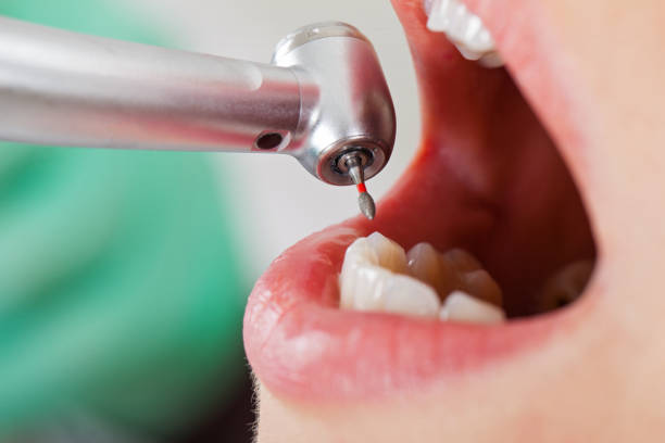 Best Lost Filling or Crown Replacement in Huntland, TN